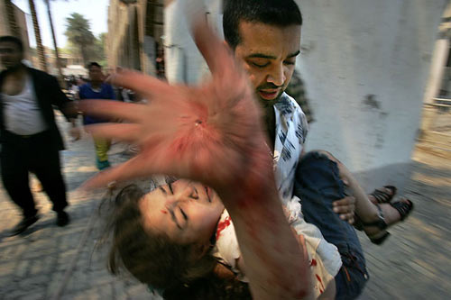 Injured Iraqi schoolgirl being rescued