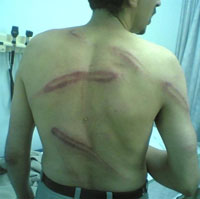 Bahrain police brutality effects