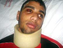 Brutalised Ali Saeed Al-Khabbaz by the Bahraini riot police sustained heavy injuries
